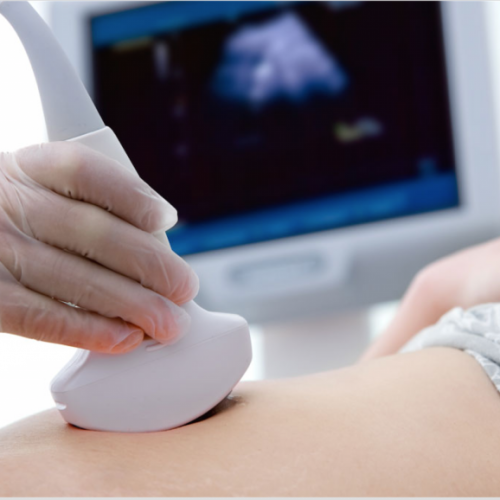 Sonography