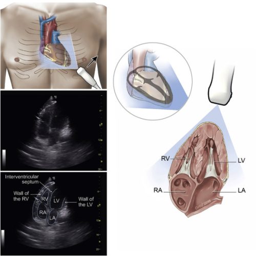 Cardiology/Echocardiology